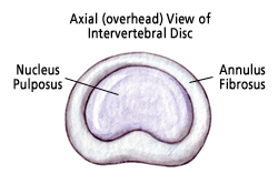 Disc Top View