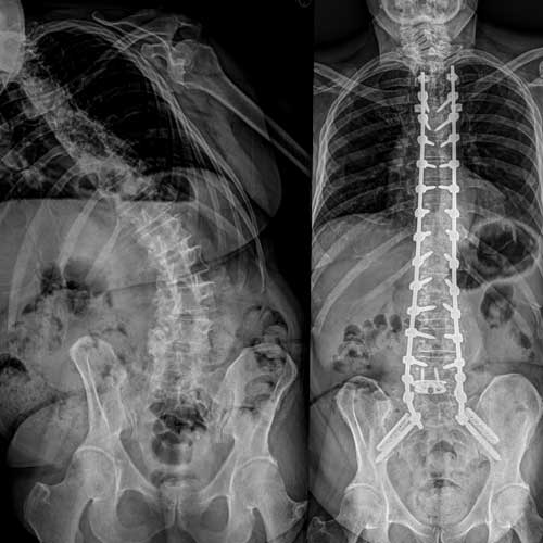 Miles AP Imaging BeforeAfter