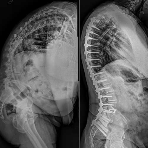 Miles Lat Imaging BeforeAfter.jpg