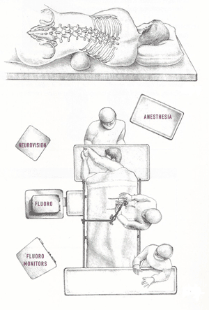 XLIF Operating Room Layout