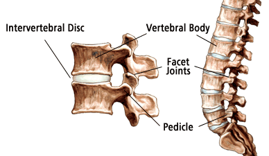 Lumbar Disc Herniation Detail